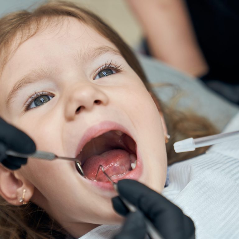 Portrait of pretty bold female child sitting in dental chair with open mouth while professional doctor in rubber gloves carefully examining condition of teeth. Concept of dentistry